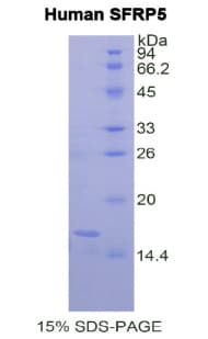 Human SFRP5 Protein (Recombinant His)