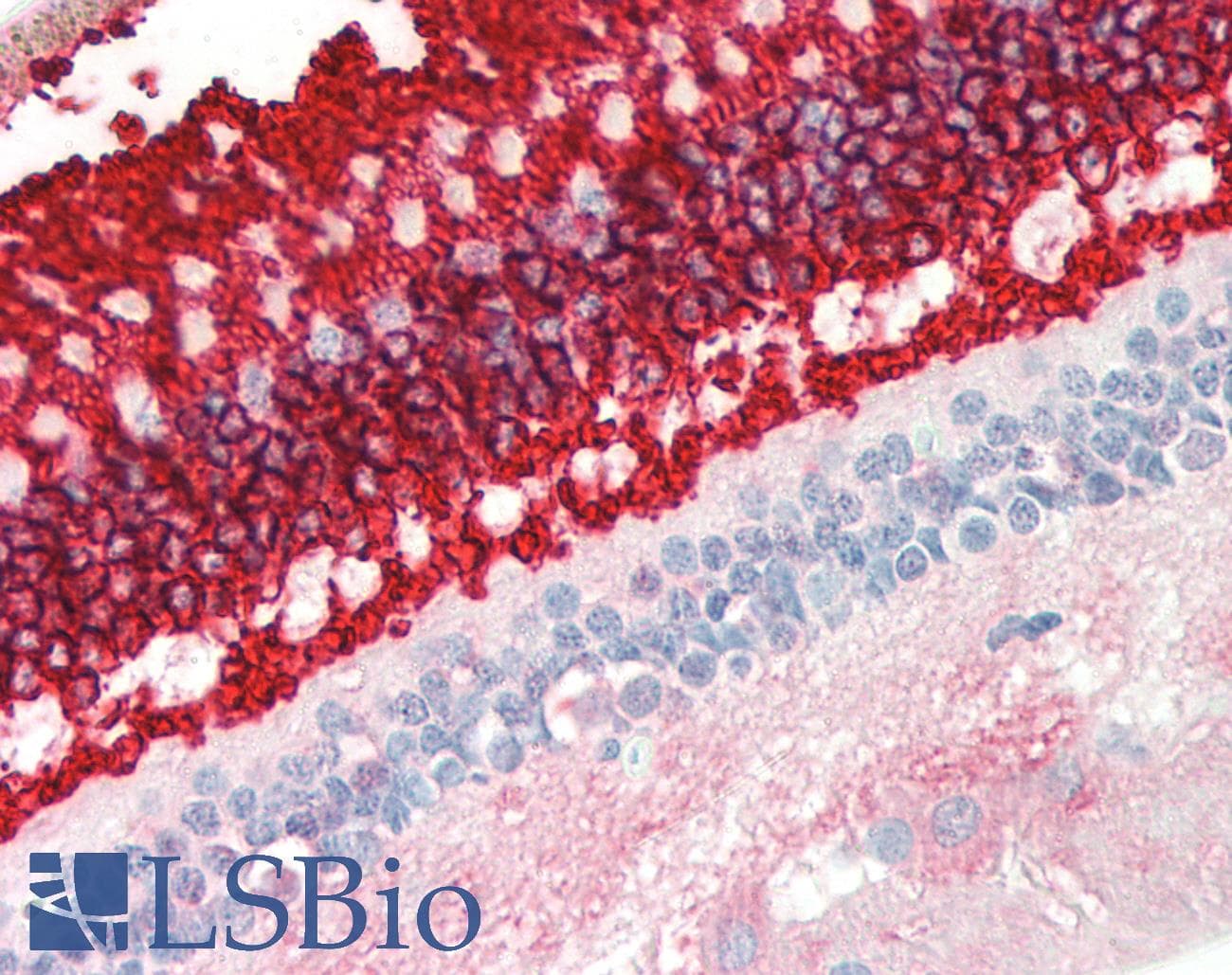 IHC-plus™ Rhodopsin / RHO Antibody (clone B630)