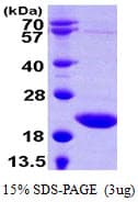 Human TSEN15 Protein (Recombinant His)