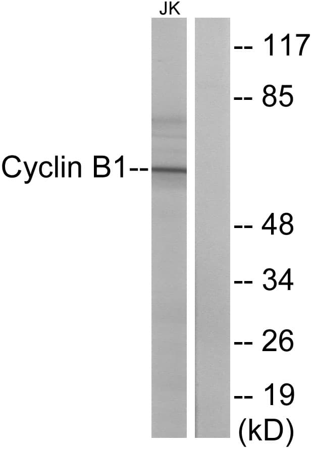CCNB1 / Cyclin B1 Antibody (aa121-170)
