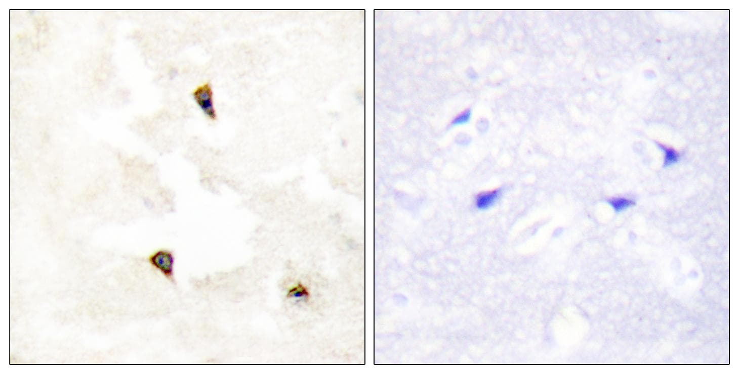 TP53I11 / PIG11 Antibody