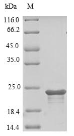 Mouse TMEM2 Protein (Recombinant 10His, N-terminus)