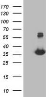 Monoclonal Mouse anti-Human MGLL / Monoacylglycerol Lipase Antibody (clone OTI1H1, IHC, IF, WB)