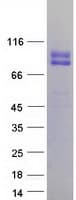 Human CD105 Protein (Recombinant Myc-DDK (Flag))