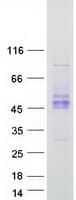 Human KIR2DS2 / CD158j Protein (Recombinant Myc-DDK (Flag))