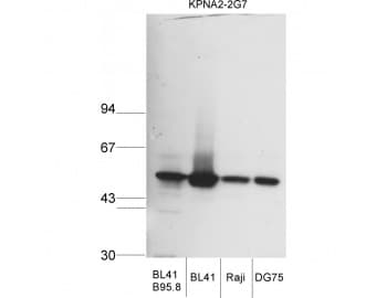 KPNA2 / Importin Alpha 1 Antibody (aa116-515, clone 2G7)