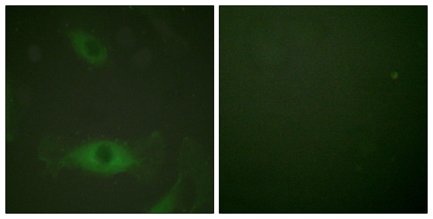 cPLA2 Antibody (phospho-Ser505)