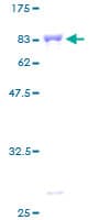 Human IMPDH2 Protein (Recombinant GST)