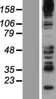 SYNJ2 / Synaptojanin 2 Protein (Over-Expression Lysate Myc-DDK (Flag))