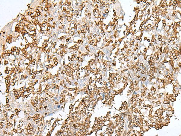 SEPT1 / Septin 1 Antibody