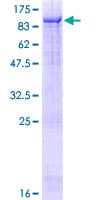 Human ZKSCAN1 / ZNF36 Protein (Recombinant GST)
