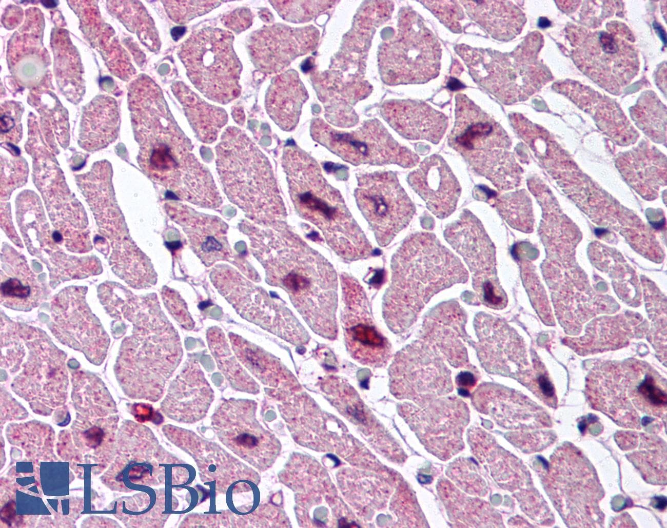 IHC-plus™ Polyclonal Rabbit anti-Human CYSLT2 / CYSLTR2 Antibody (C-Terminus, IHC)