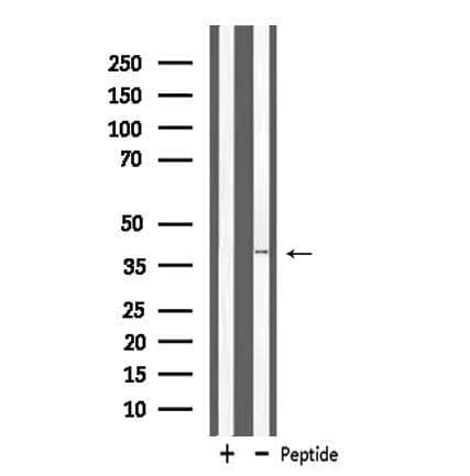 MRPL3 Antibody