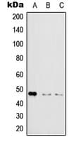 IKBKG / NEMO / IKK Gamma Antibody (phospho-Ser31)