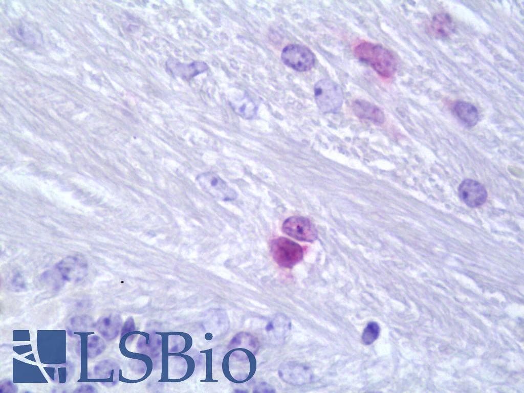 PathPlus™ Polyclonal Rabbit anti-Mouse OLIG1 Antibody (IHC, WB)