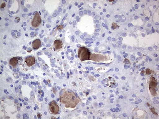 FCMR / FAIM3 Antibody (clone OTI1E6)