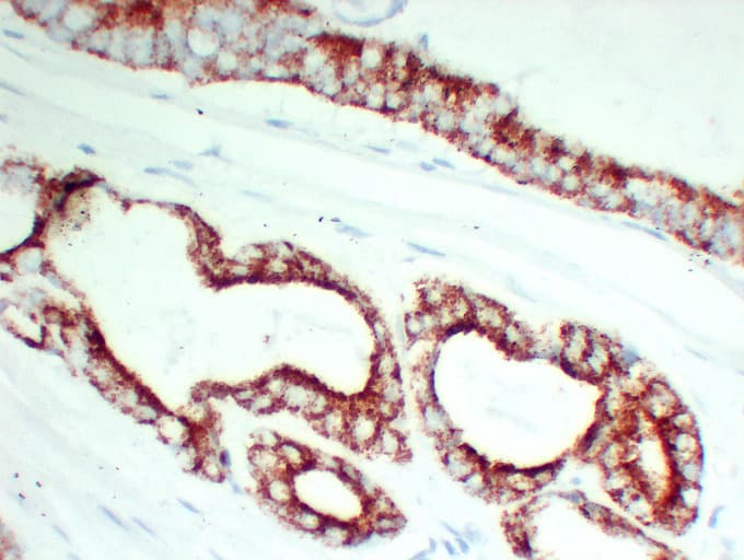 Monoclonal Mouse anti-Human AMACR / P504S Antibody (clone ABT-AMACR, IHC, WB)
