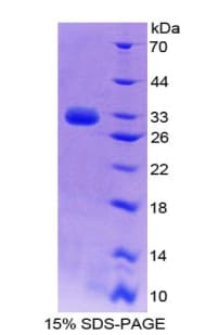 Rat NOTCH4 Protein (Recombinant His-T7)