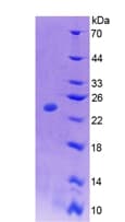Mouse CSF1 / MCSF Protein (Recombinant His, N-Terminal)