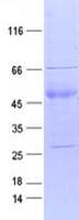 Human LTK Protein (Recombinant DDK,C-terminus)