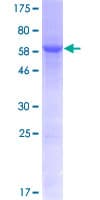Human GDAP1L1 Protein (Recombinant GST)