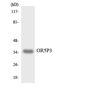 JCG1 / OR5P3 Antibody (aa45-94)