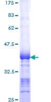Human SIK2 / SNF1LK2 Protein (Recombinant GST, N-terminus)