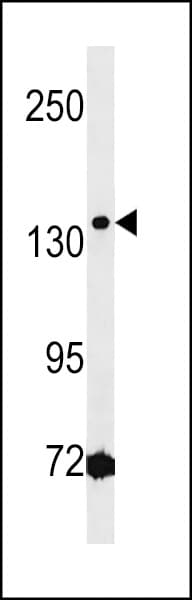 HMGXB3 / SMF Antibody (aa879-908)