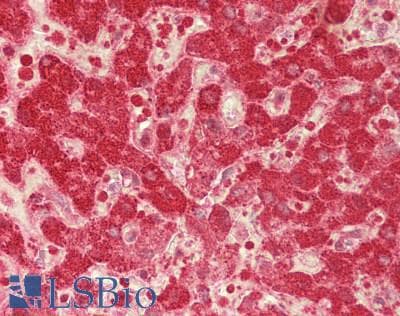 IHC-plus™ CFHR3 / CFHL3 Antibody