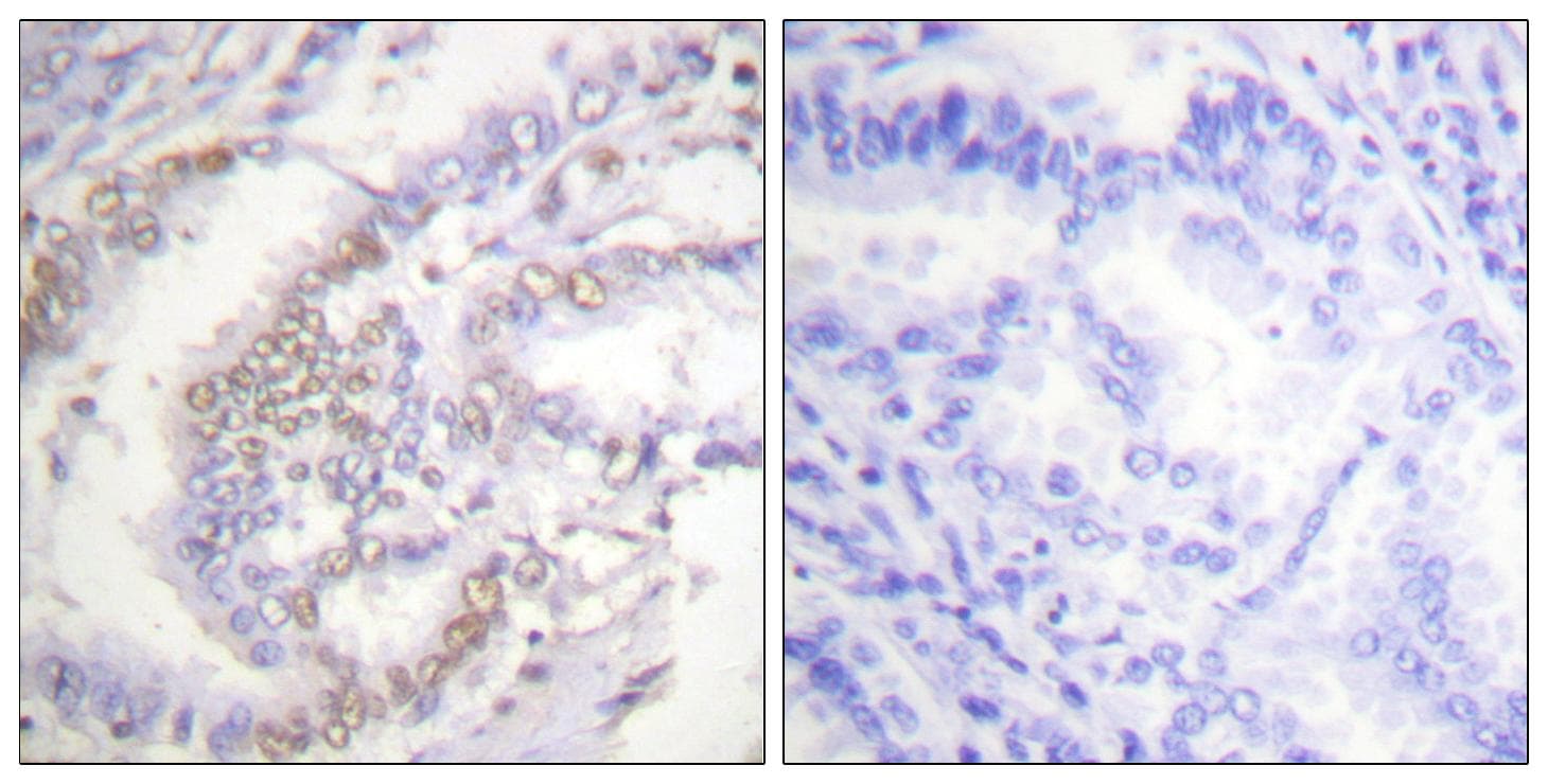 XRCC6 / Ku70 Antibody (phospho-Ser5)