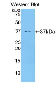 KRT19 / CK19 / Cytokeratin 19 Antibody (aa83-390)