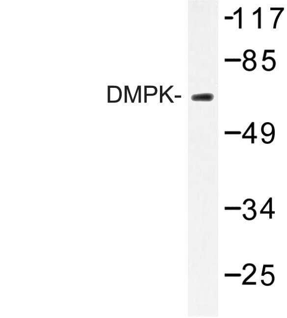 DMPK / DM Antibody (Arg30)