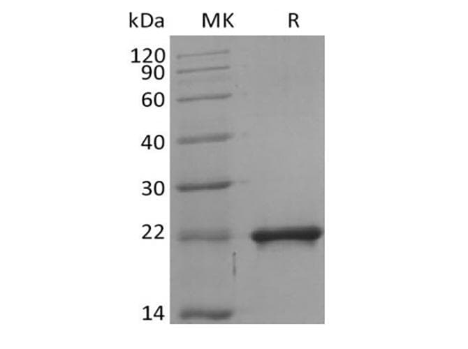 Mouse SHH / Sonic Hedgehog Protein (Recombinant 6His, C-terminus)