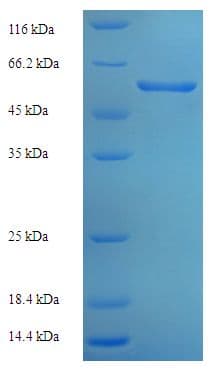 Human XRCC3 Protein (Recombinant His-SUMO)