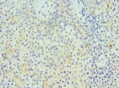 GZMA / Granzyme A Antibody (aa29-262)