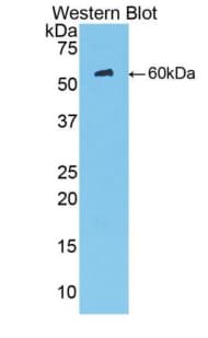 MBL2 / Mannose Binding Protein Antibody (aa130-248, Biotin)