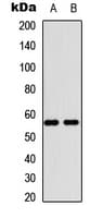 Polyclonal Rabbit anti-Human MBTPS2 Antibody (Internal, WB)