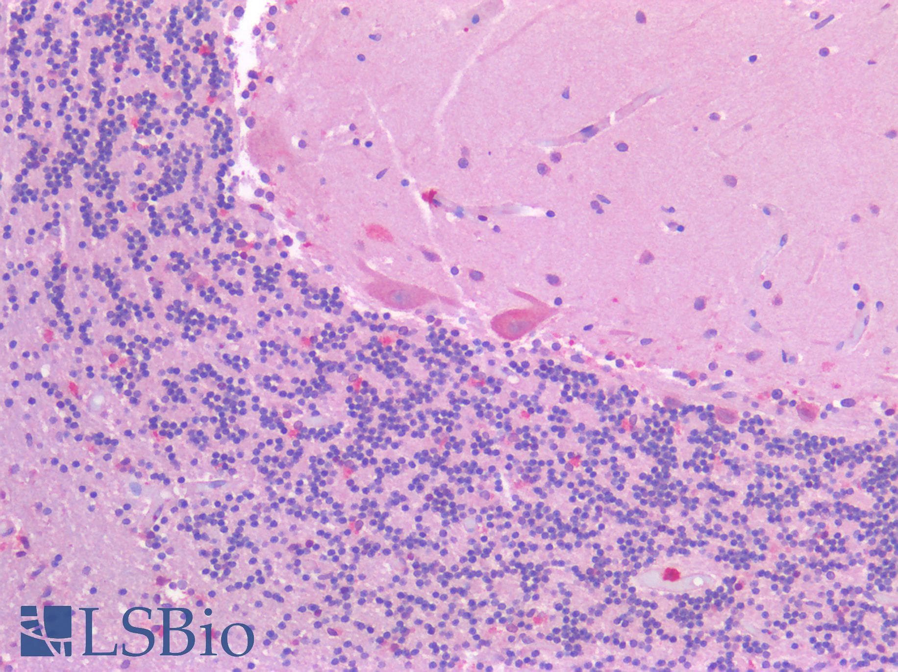 IHC-plus™ CSMD1 Antibody