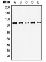 Polyclonal Rabbit anti-Human JUP/CTNNG/Junction Plakoglobin Antibody (C-Terminus, IHC, IF, WB)