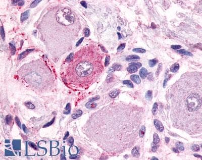 IHC-plus™ MRGPRE / MRGE Antibody (C-Terminus)
