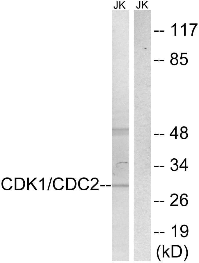 Polyclonal Rabbit anti-Human CDK2 Antibody (aa1-50, WB)