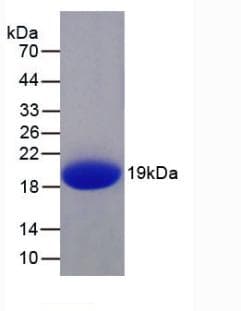 Human IL1F9 Protein (Recombinant His, N-Terminal)