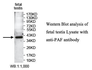 Polyclonal Rabbit anti-Human PCNA-Associated Factor Antibody (aa8-101, WB)