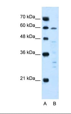 IL10RA Antibody (aa128-177, FITC)