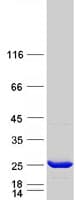 Human GSTK1 Protein (Recombinant Myc-DDK (Flag))