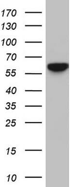 Polyclonal Rabbit anti-Human RELA / NFKB p65 Antibody (aa100-170, IHC, WB)