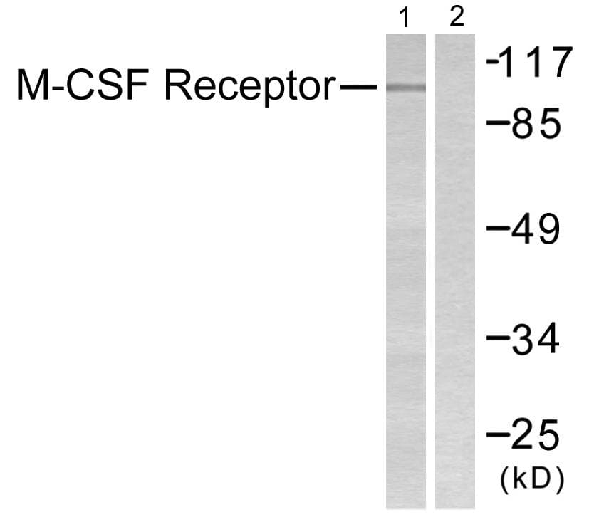 Polyclonal Rabbit anti-Human CSF1R / CD115 / FMS Antibody (p809, WB)