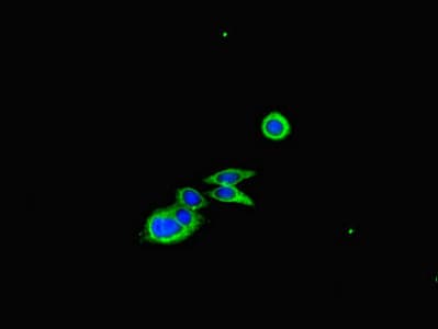 CFL1 / Cofilin Antibody