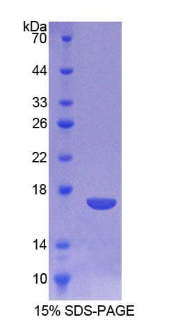 Human CTSD / Cathepsin D Protein (Recombinant His)