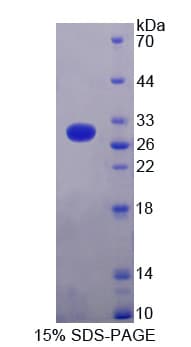 Pig TNNI3 / Cardiac Troponin I Protein (Recombinant His-T7)